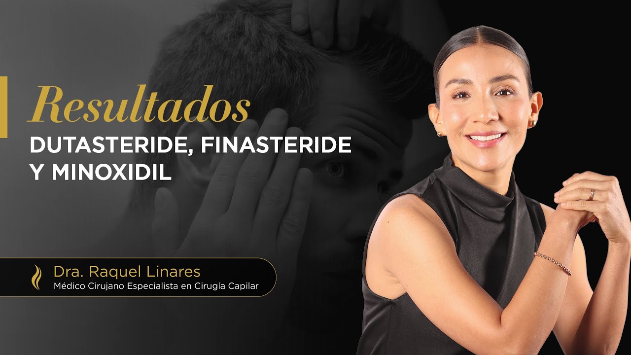 ¿Cuándo veré mi máximo engrosamiento capilar con #dutasteride / #finasteride + #minoxidil?