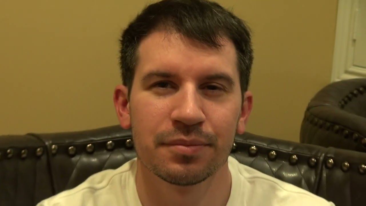 Hair Loss Treatment 3 Months After FUE Hair Transplant Men | [Type of transplant] (# Hair grafts)