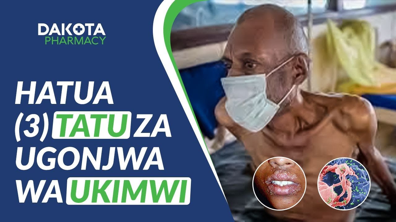 HATUA 3 ZA UGONJWA WA UKIMWI NA DALILI ZAKE