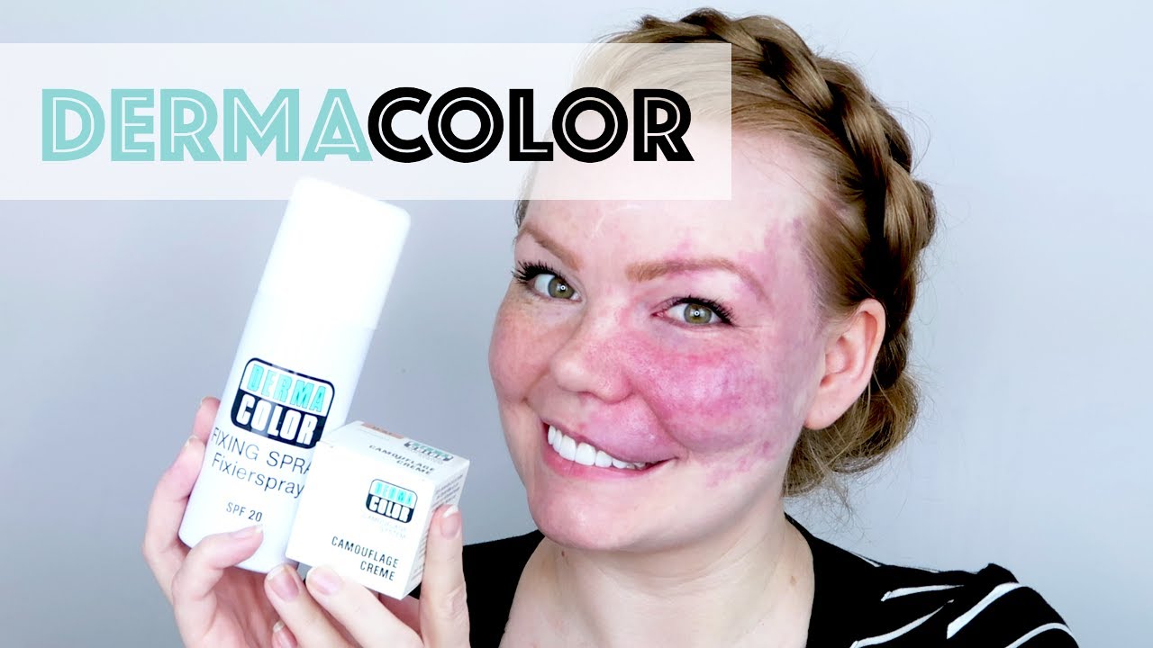 DermaColor Camouflage Creme  - How Well Does It Cover A Birthmark?