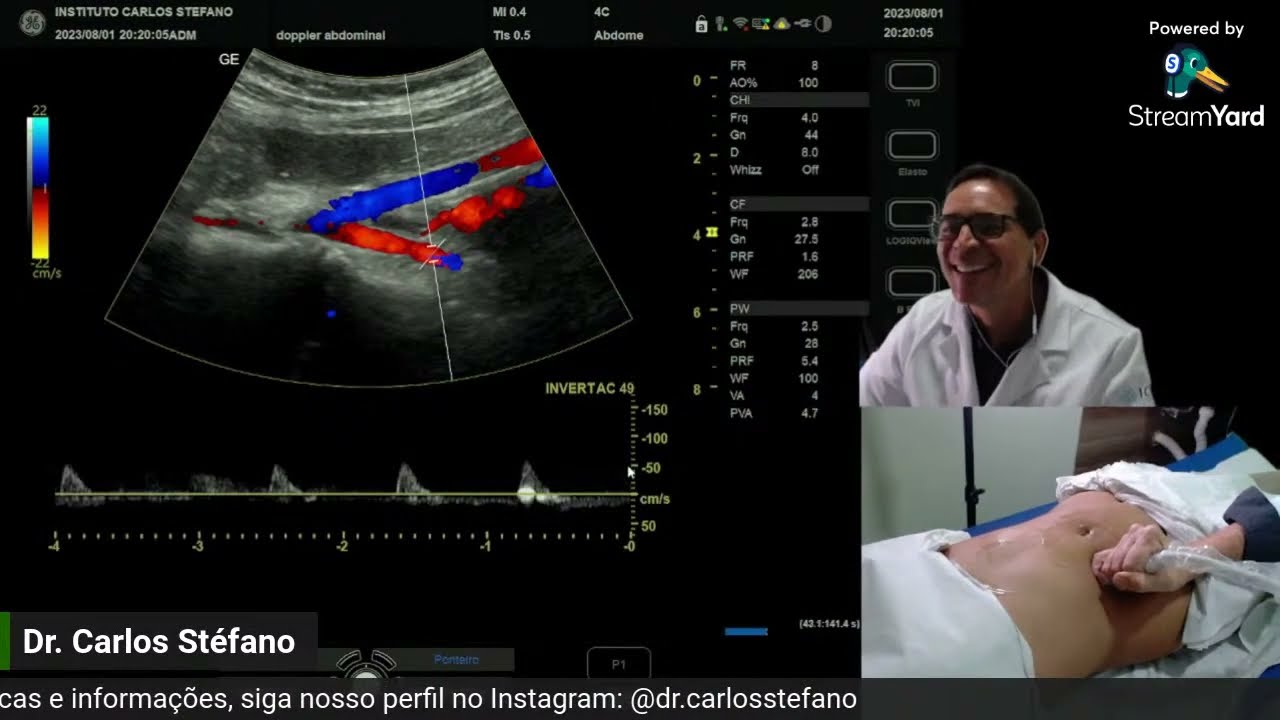 Aula ao vivo: Ultrassom DOPPLER Abdominal