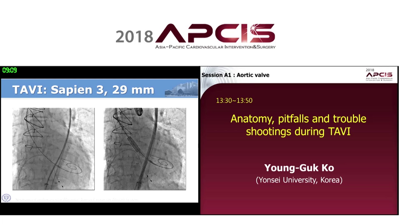 Anatomy, pitfalls and trouble shootings during TAVI