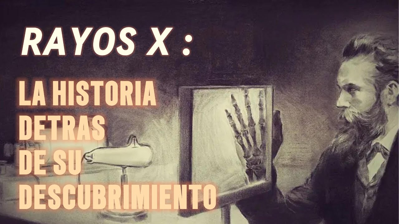 Rayos X: ¿Quién, Cómo y Cuándo los Descubrió? | Historia Completa de Wilhelm Röntgen