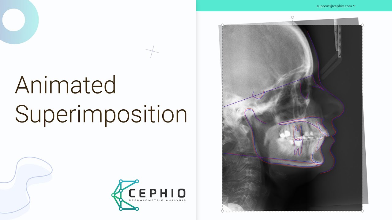 Animated Superimposition