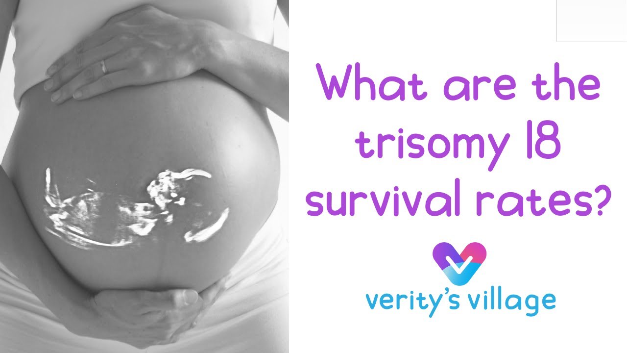 What are the survival rates for rare trisomies?