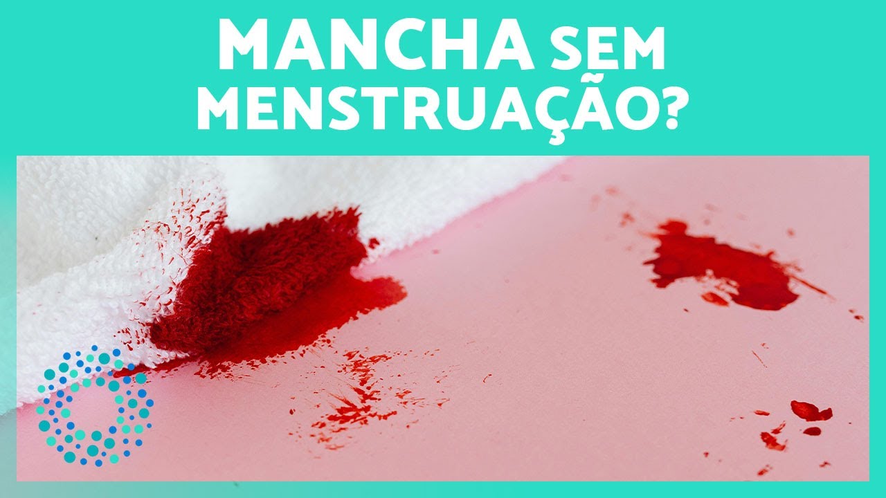 Por que apresento SANGRAMENTO apenas ao ME LIMPAR? 🩸🧻 (Causas e Possíveis Tratamentos)