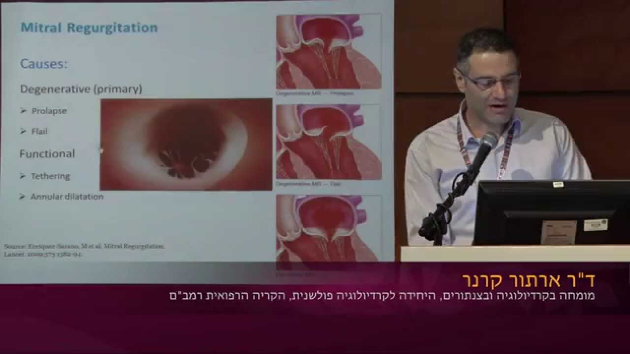 מסתמי הלב | בטיפול באמצעות צנתור - ד