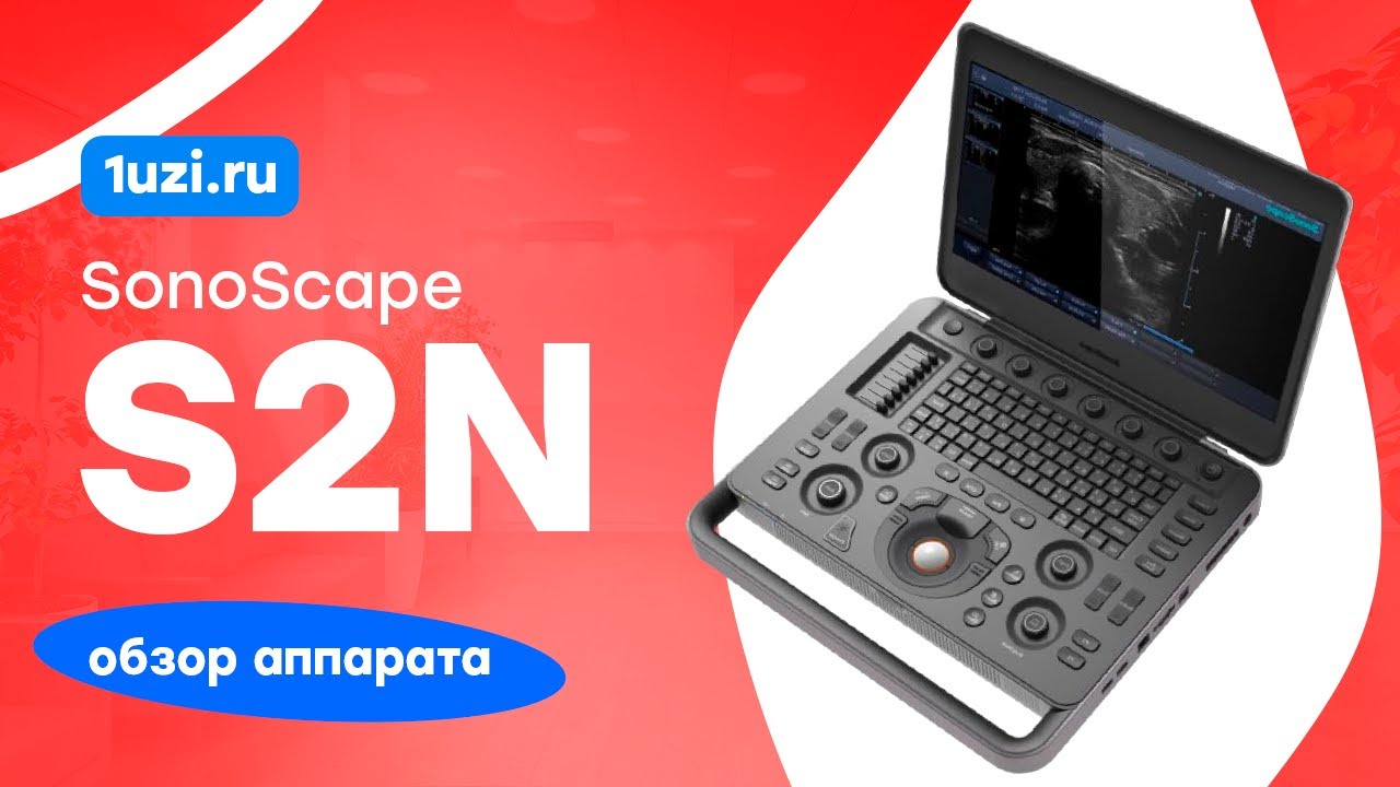 Обзор УЗИ аппарата SonoScape S2N