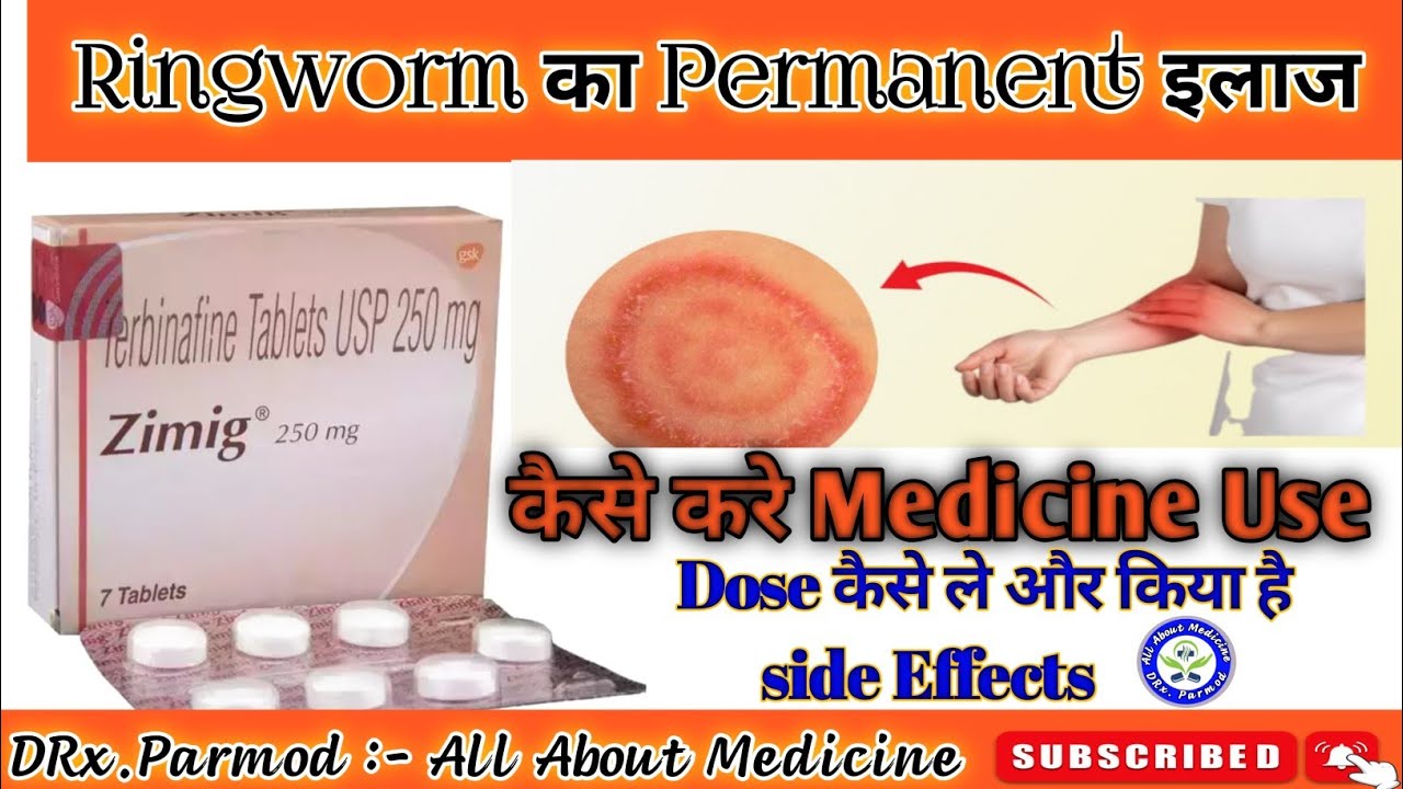 Zimig Tablet (Antifungal medicine) Ringworm treatment