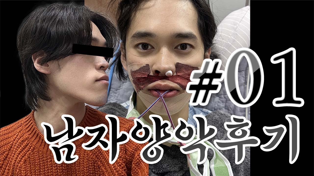 삼구 남자양악후기 브이로그 1편