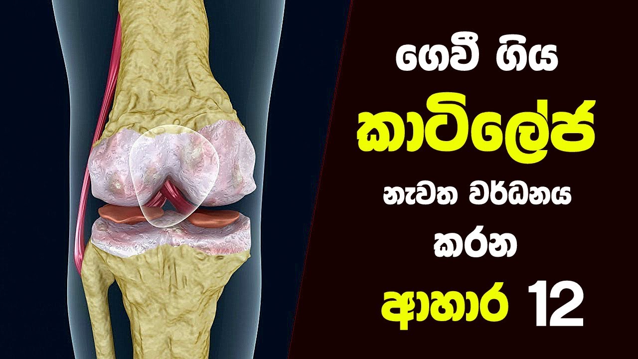 ගෙවී ගිය කාටිලේජ නැවත වර්ධනය කරන්නට උදව් වෙන ආහාර 12 ක් - 12 Foods that Help Rebuild Cartilage