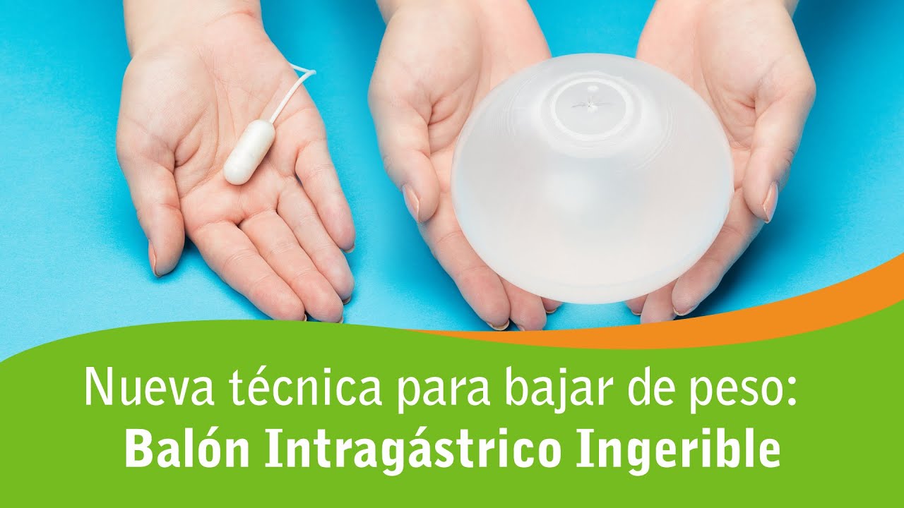 Nueva técnica para bajar de peso: Balón Intragástrico Ingerible