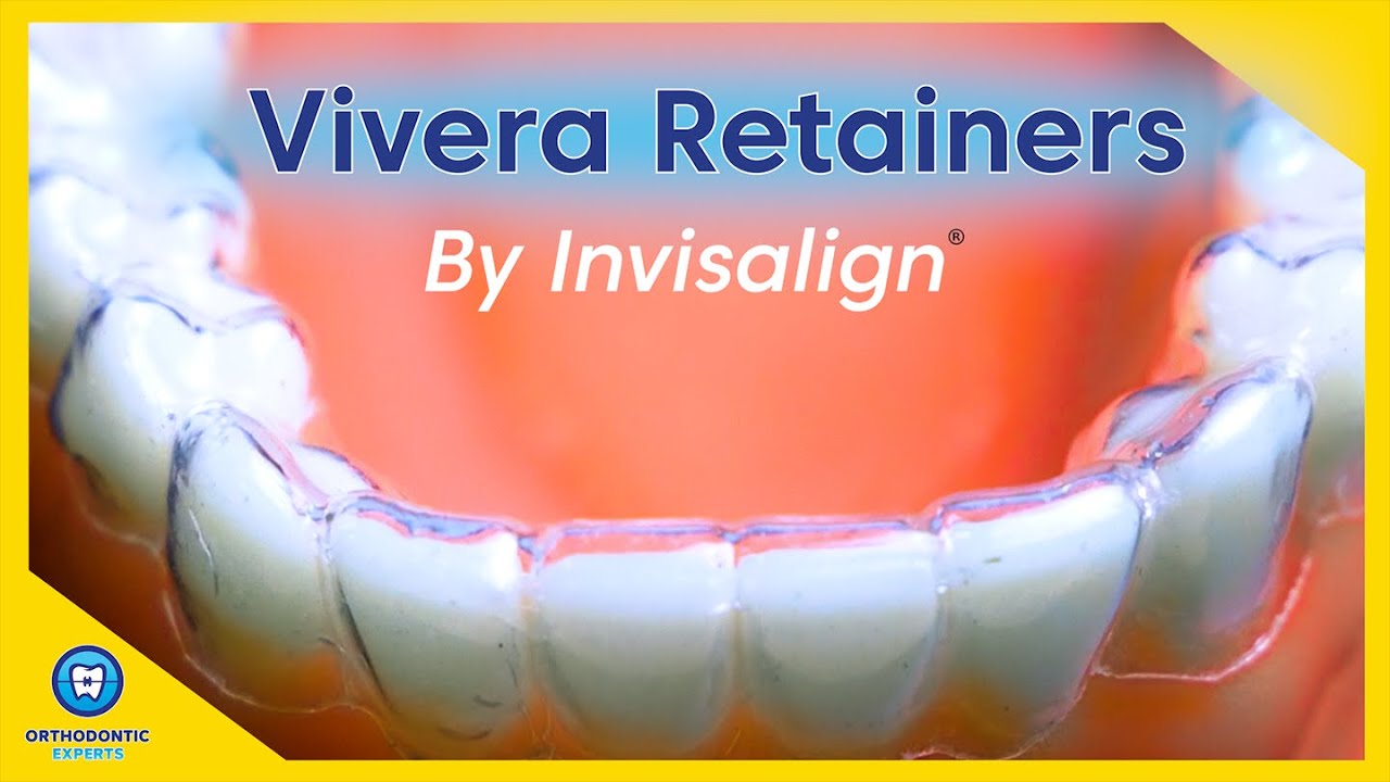 Являются ли ретейнеры Vivera лучшим вариантом?