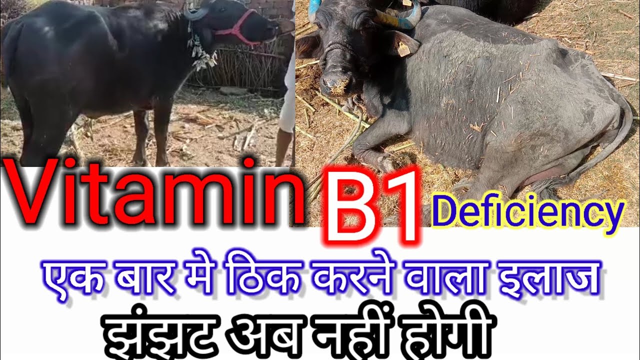 Vitamin B1 Deficiency | Vitamin B1 Deficiency Symptoms In Hindi || Polio -Encefhalomalacia | Hindi