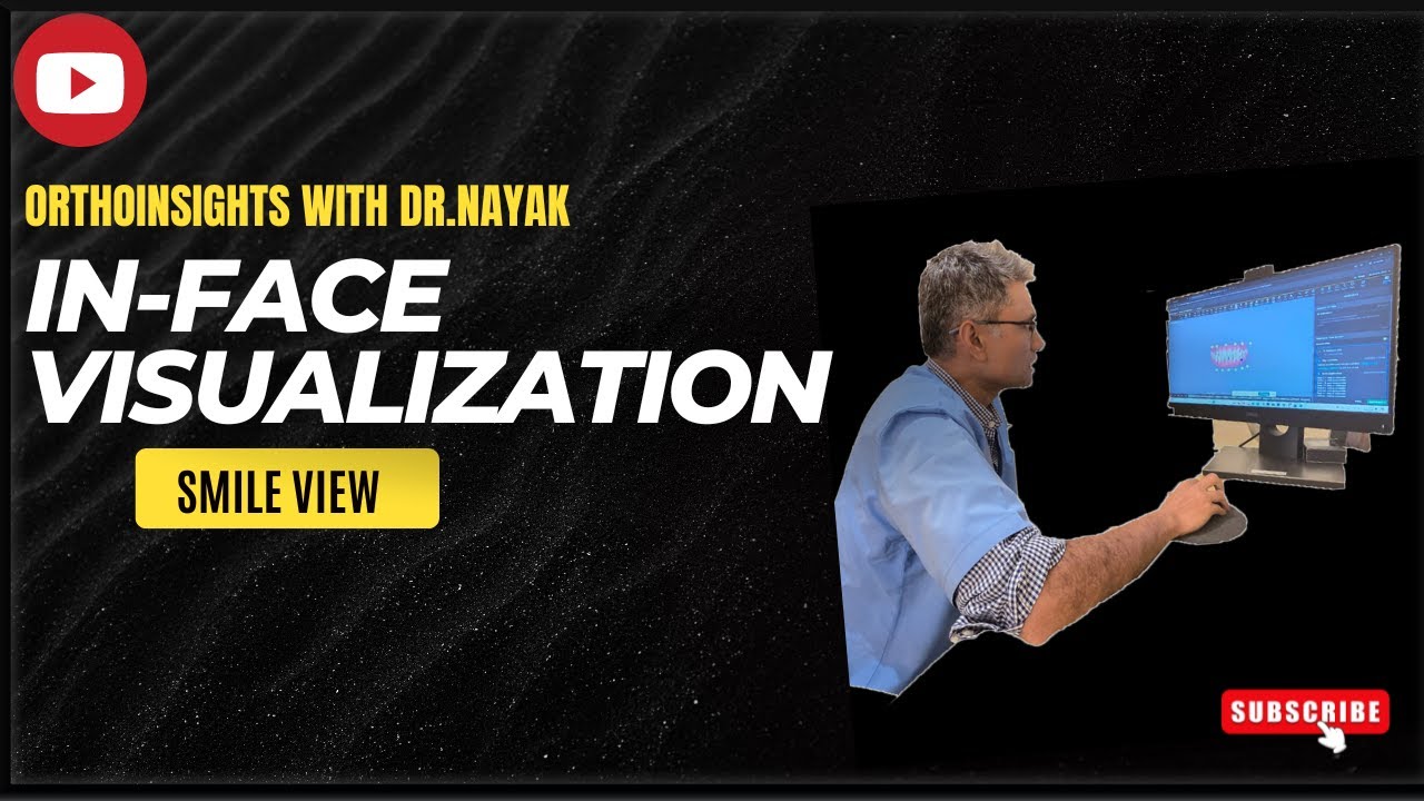 In-Face Visualization : Invisalign's Smile View Demonstration