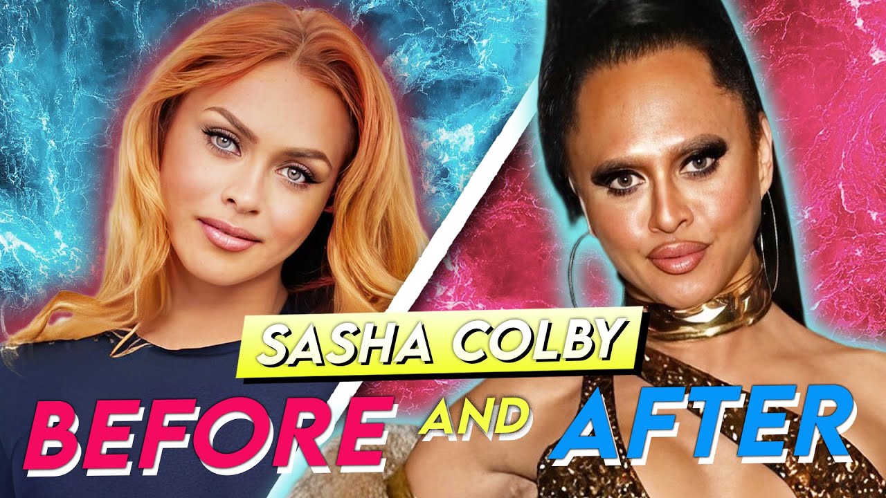 Саша Колби | До и после | Пластическая хирургия: преображение