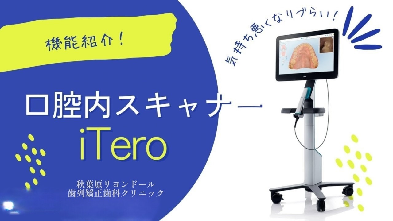 【秋葉原リヨンドール歯列矯正歯科クリニック】AIで before→afterがわかる？！口腔内スキャナー
