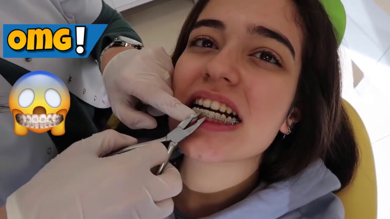 Diş tellerim çıkıyor! | Okul Sınıf arkadaşlarım💛