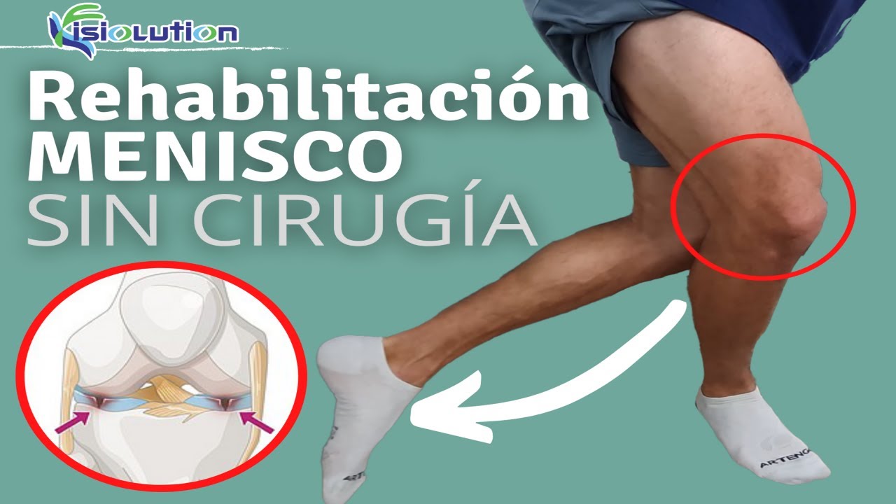 ROTURA de MENISCO RODILLA - REHABILITACIÓN SIN CIRUGIA - EJERCICIOS y Fisioterapia | Fisiolution