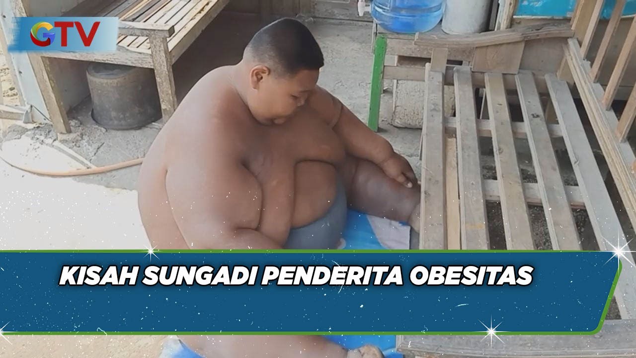 Kisah Sungadi, Pemuda Asal Sragen Penderita Obesitas Berharap Bantuan Pemda - BIP 27/05
