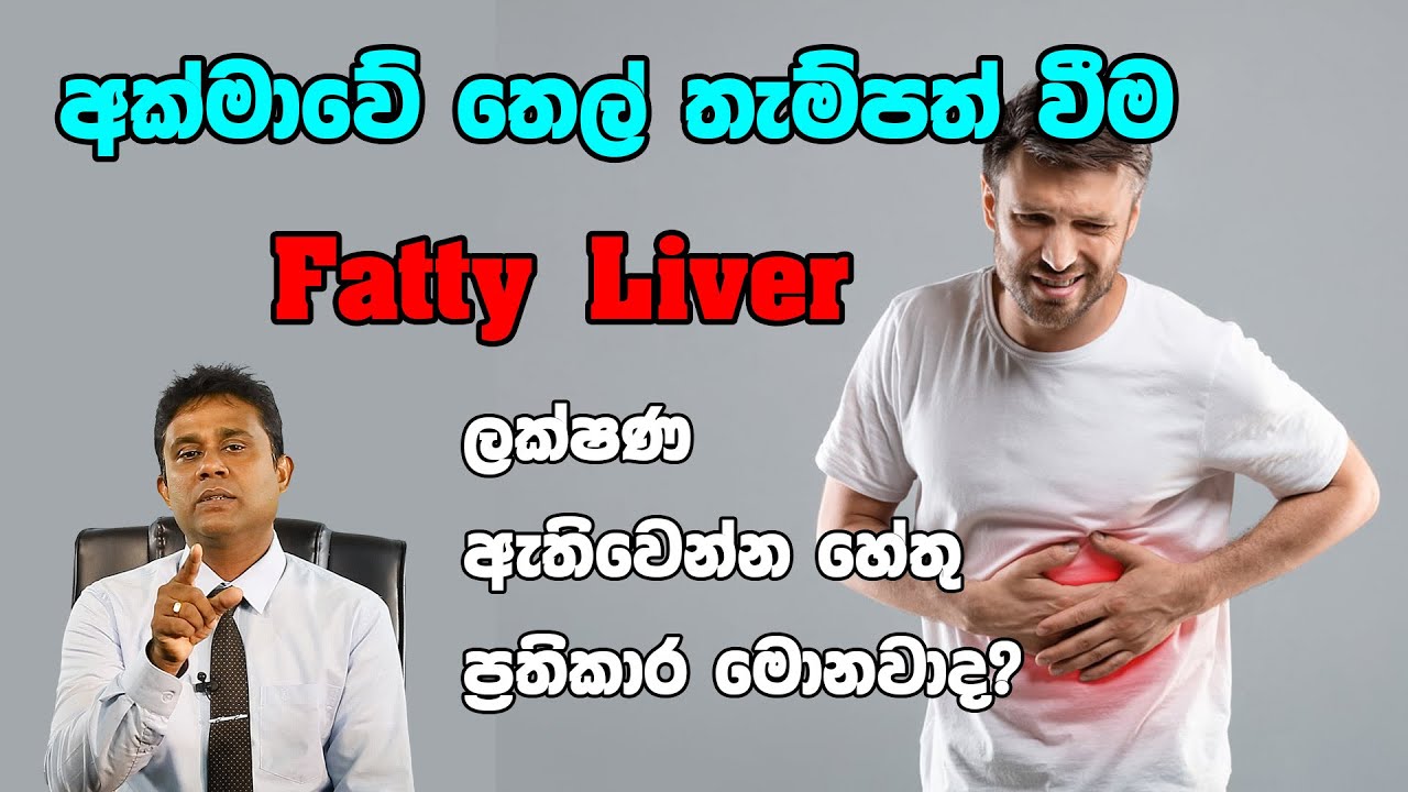 ඔබේ අක්මාවේ තෙල් තැම්පත් වෙලාද ?  අක්මාවේ තෙල් වලට බෙහෙත්  fatty liver treatment    Akmawe thel