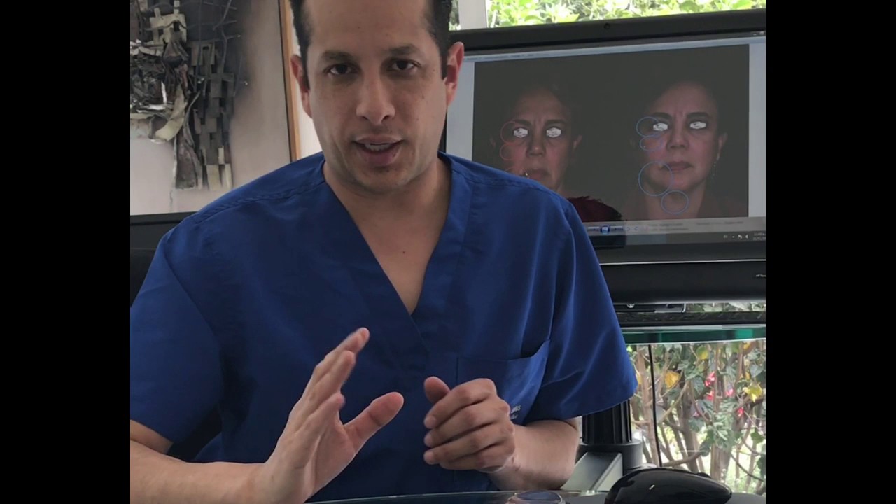 Rejuvenecimiento facial | Dr. Ivan Santos - Cirugía plástica en Colombia |