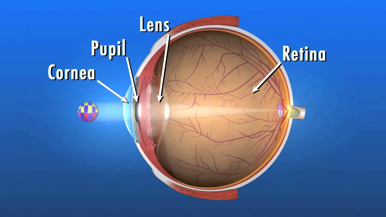 What is a Cataract and how does it affect my vision?