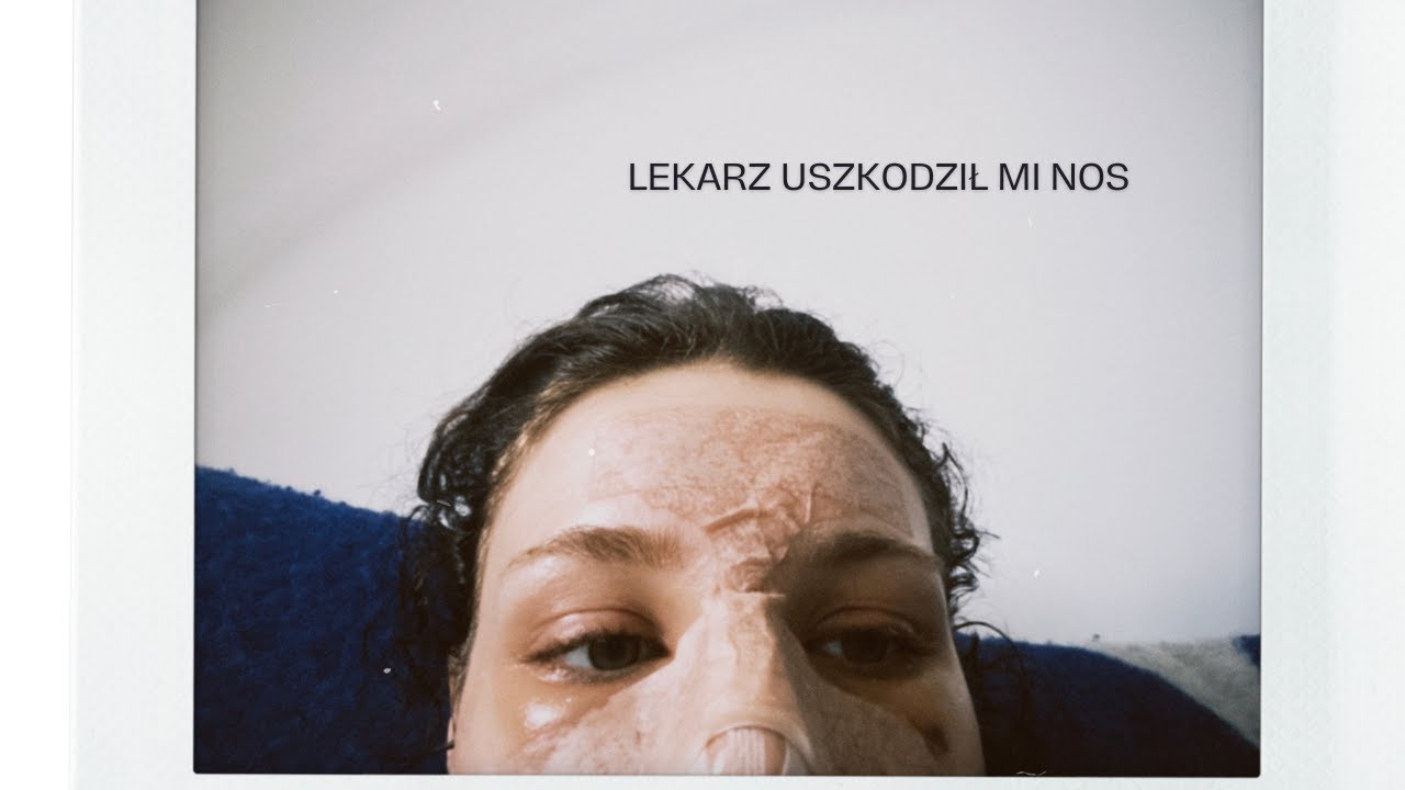 obejrzyj zanim zrobisz sobie nos