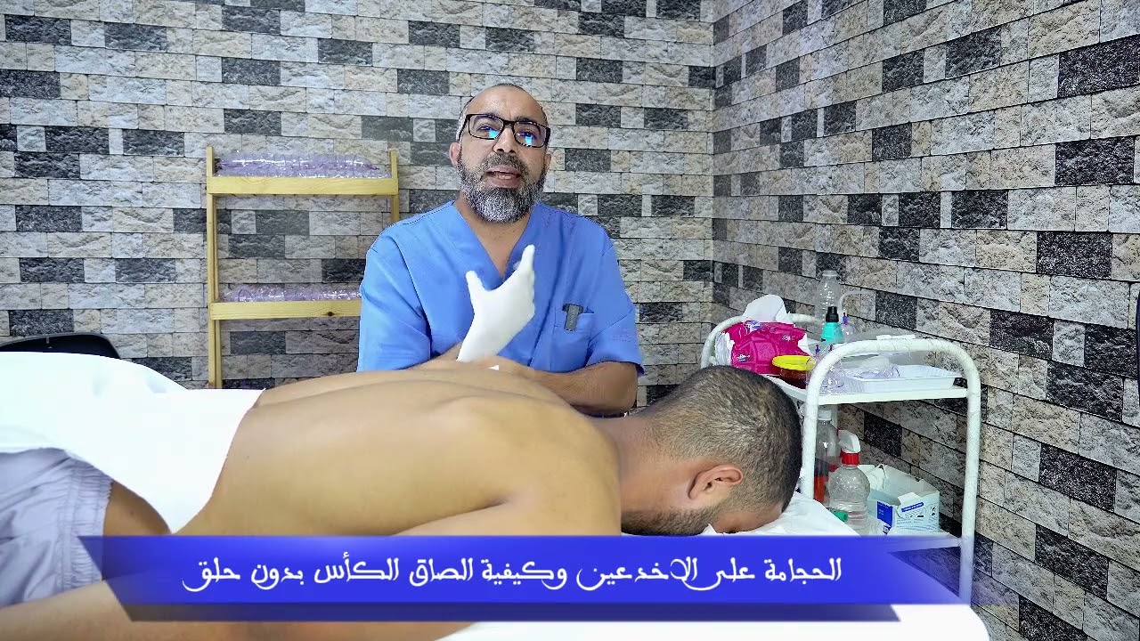 الحجامة على الأخدعين وطريقية الصاق الكأس بدون خلق الشعر