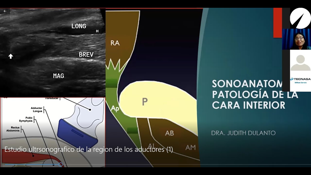 Como evaluar los aductores ultrasonido resonancia. Dra. Judith Dulanto