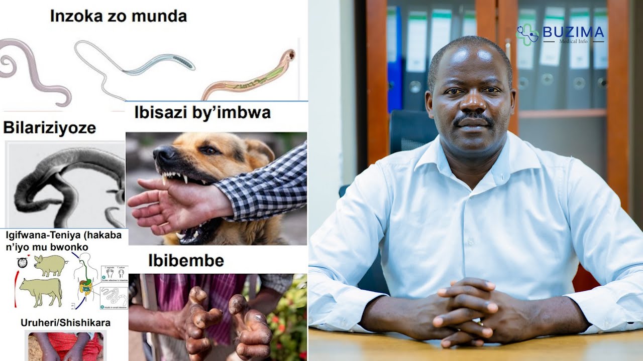 IBISAZI BY'IMBWA, BILARIZIYOZE, TENIYA...NI INDWARA ZITITAWEHO UKO BIKWIYE  KANDI ZIHANGAYIKISHIJE