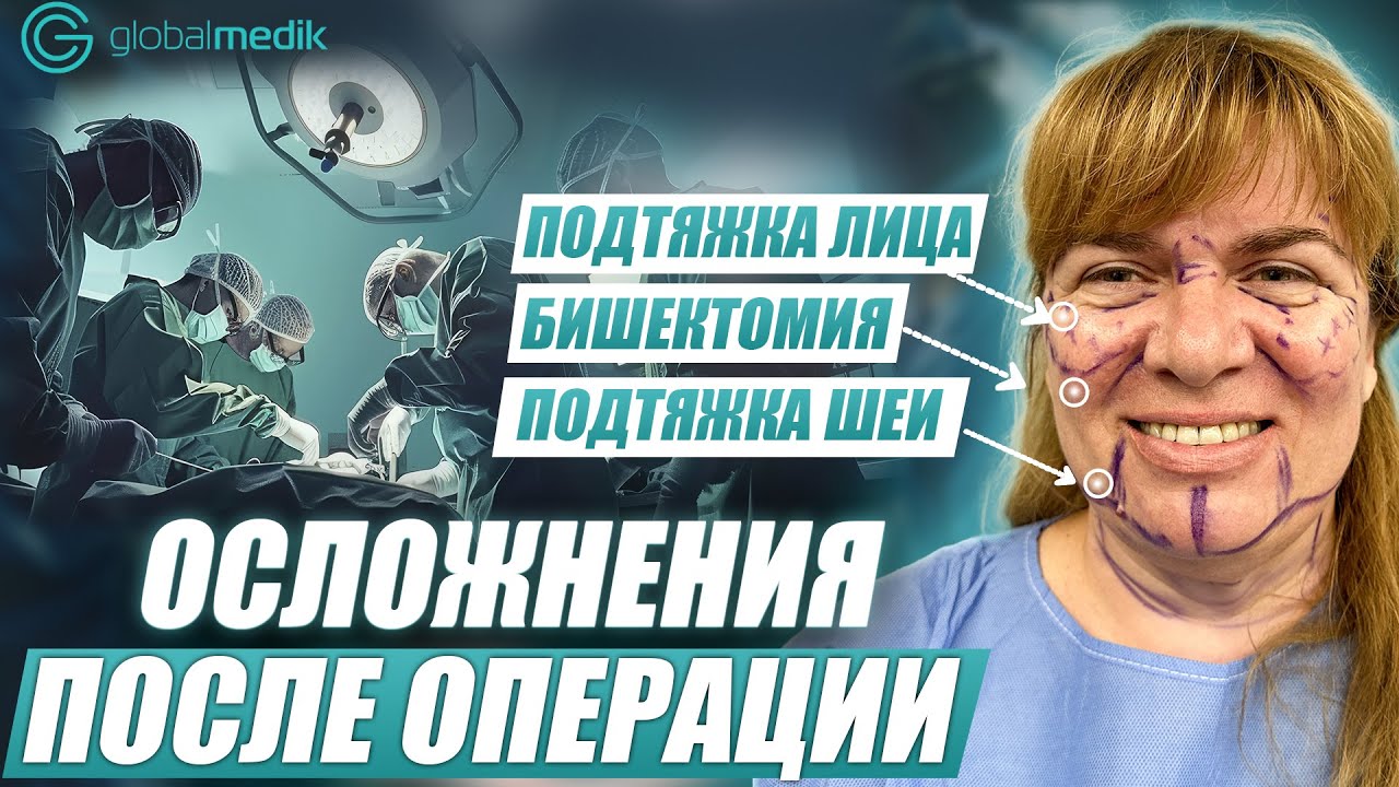 SMAS подтяжка лица в 50 лет: личный опыт Марины | Операция и реабилитация в Стамбуле