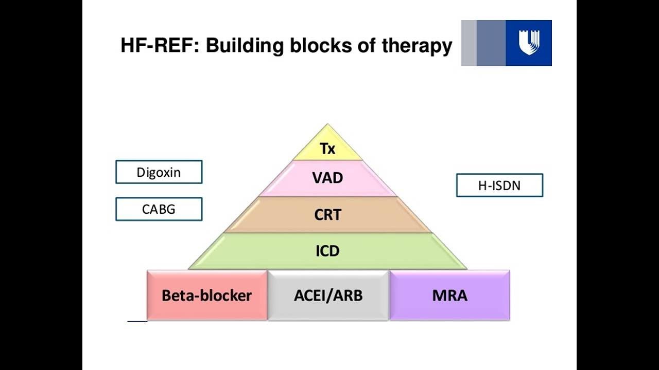 When to think of CRT & ICD, Dr. Sherif Altoukhy