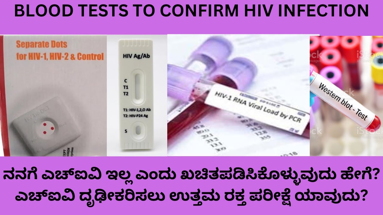 BLOOD TESTS TO DIAGNOSE CONFIRM ANDTREAT HIV.RAPID HIV TEST,HIV RNAVIRAL LOAD,4TH GENERATION HIVTEST
