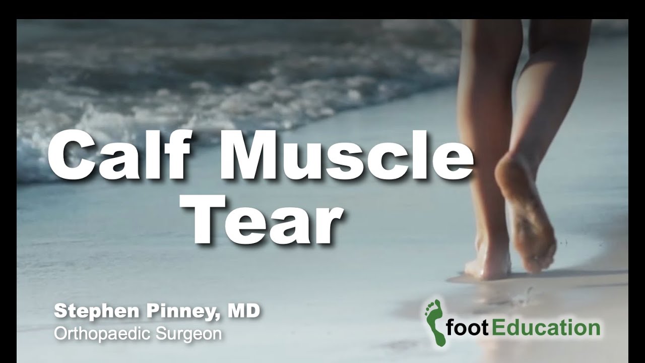 Calf Muscle Tear