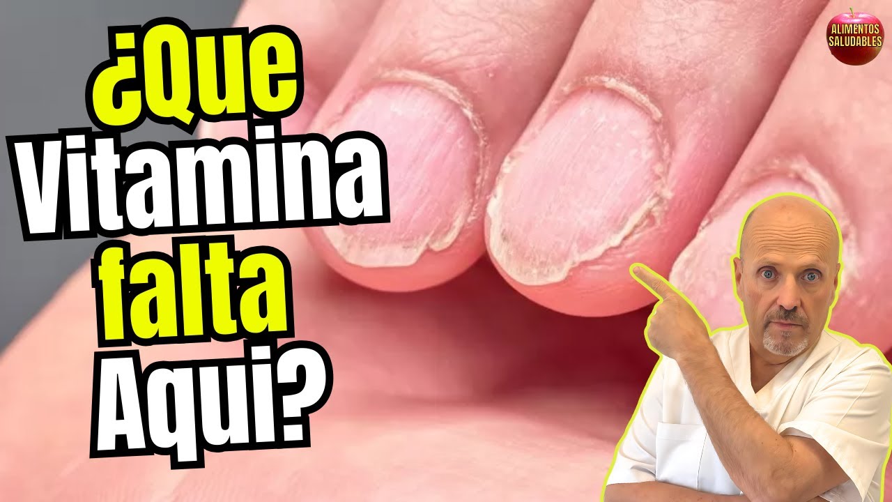 💅🧪¿QUÉ VITAMINA ME FALTA SI TENGO LAS UÑAS QUEBRADIZAS? 💅🧪