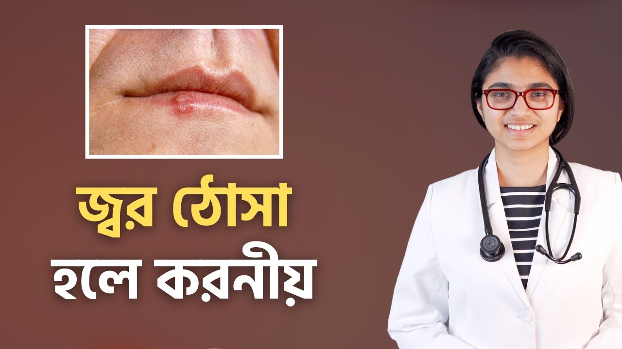 জ্বর ঠোসা কেন হয়? জ্বর ঠোসা হলে করনীয় — ডা. তাসনিম জারা (চিকিৎসক, ইংল্যান্ড)