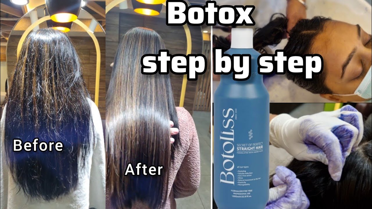 HOW TO : BOTOLISS BOTOX TREATMENT | BOTOX  कैसे करते है ? |  STEP BY STEP | TUTORIAL | Divya pal