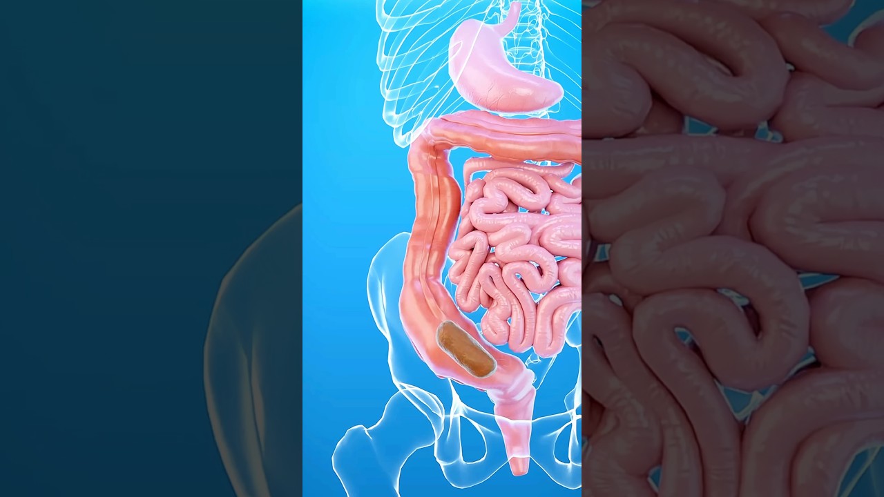 Qu'est-ce que la constipation ? 💩🤔