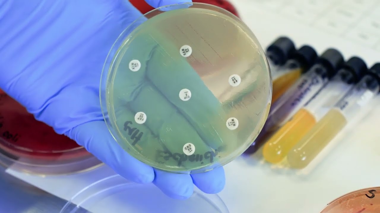 Bacilos Gram negativos Enterobacterias y Bacilos Gram negativos no fermentadores