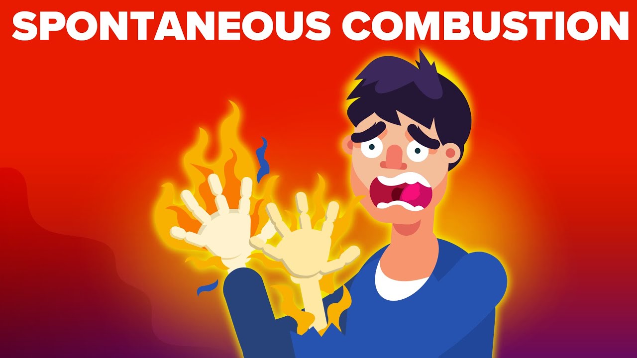 A Real Case Of Spontaneous Human Combustion