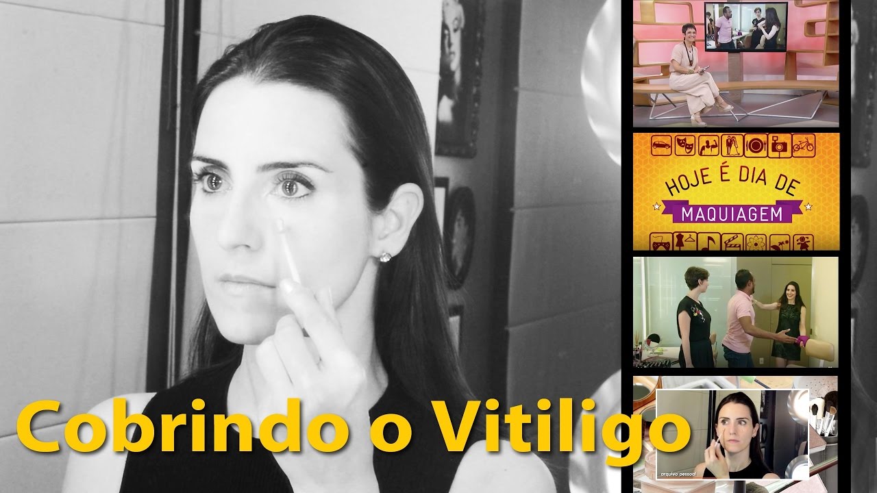 Cobrindo o Vitiligo | Passo a passo da matéria que gravei para a Globo
