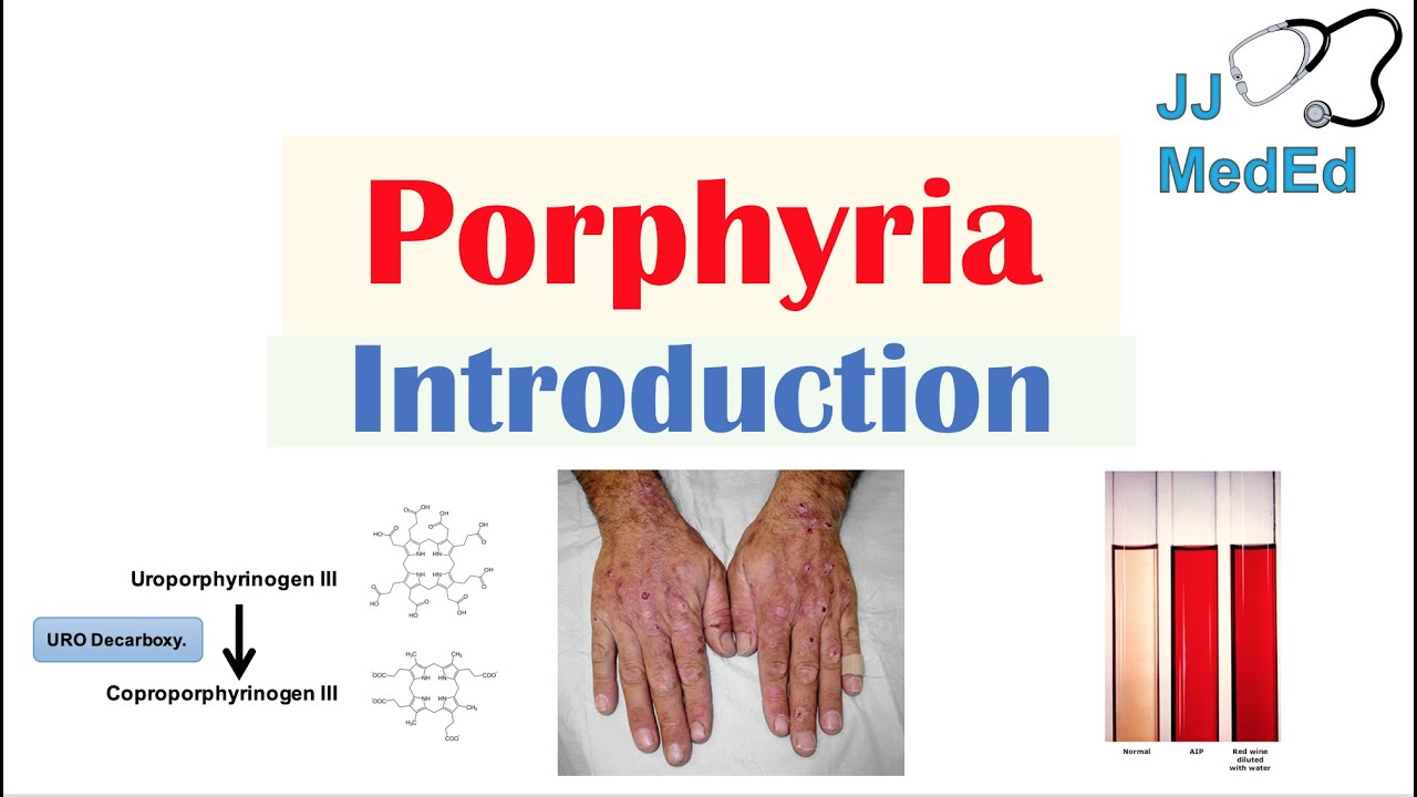 Introduction to Porphyria | Porphyria Cutanea Tarda vs. Acute Intermittent Porphyria