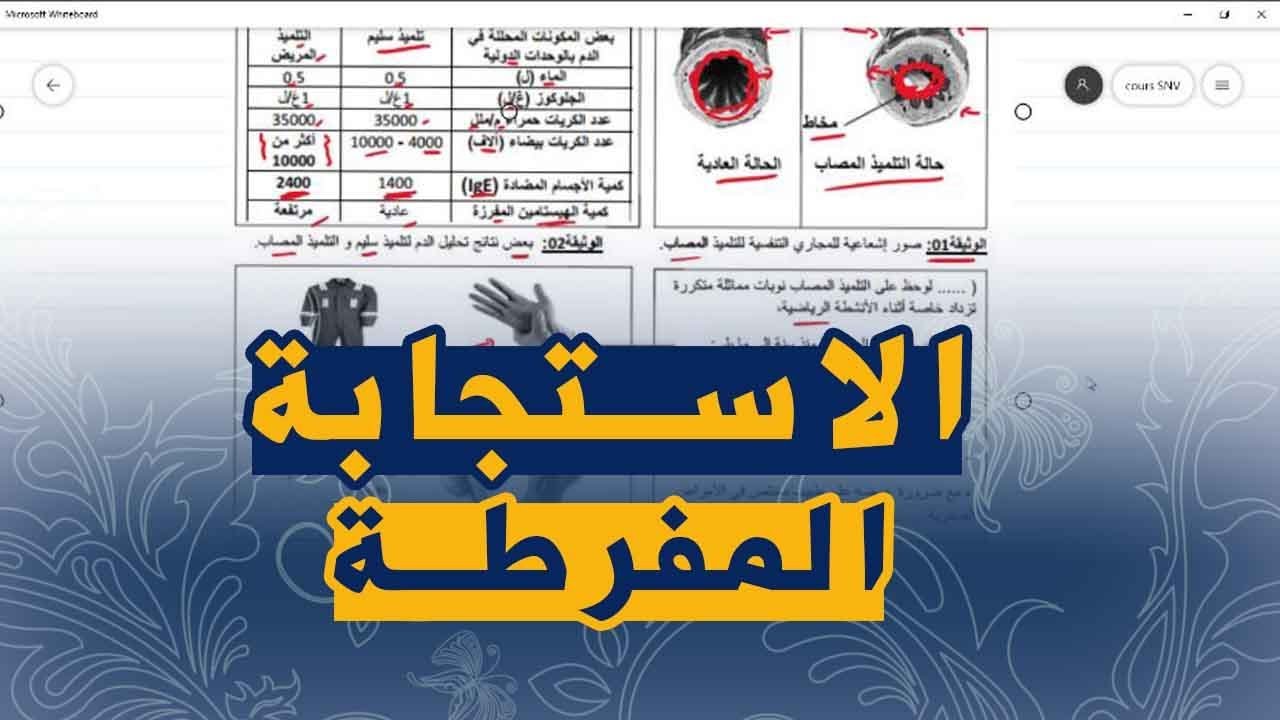 وضعية ادماجية جيدة على الحساسية علوم طبيعية للسنة الرابعة متوسط