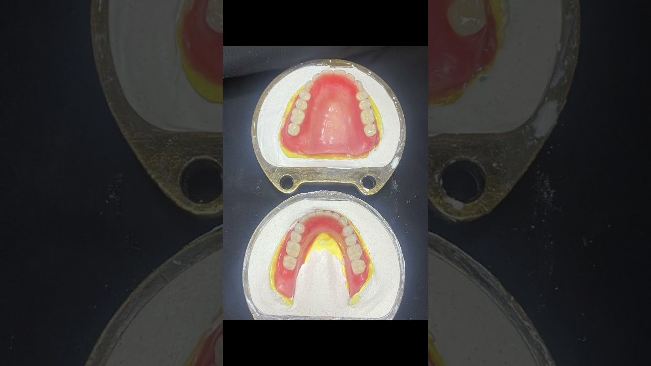 Thử răng ổn, &eacute;p nhựa xong LỎNG, nguy&ecirc;n nh&acirc;n c&oacute; thể c&oacute;