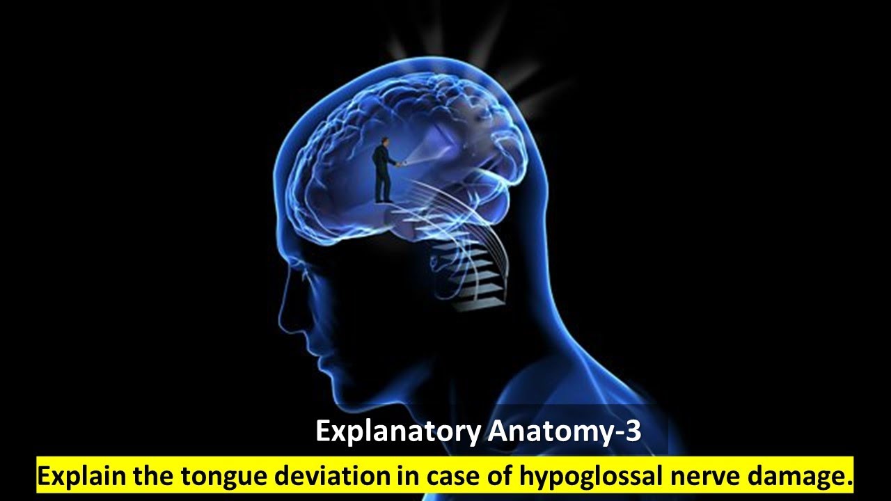 Explain the tongue deviation in case of hypoglossal nerve damage.