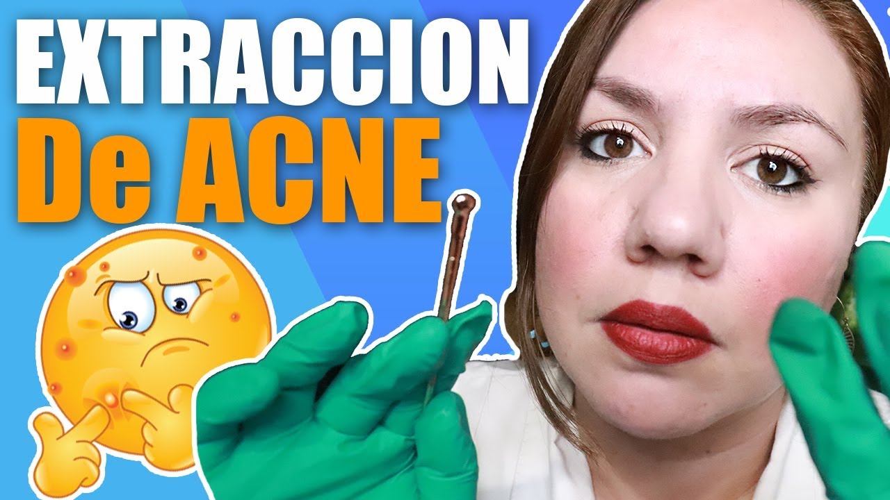 ASMR Dermatologa Examen y Extracción de ACNE RoIePIay / Murmullo Latino / ASMR Mexico