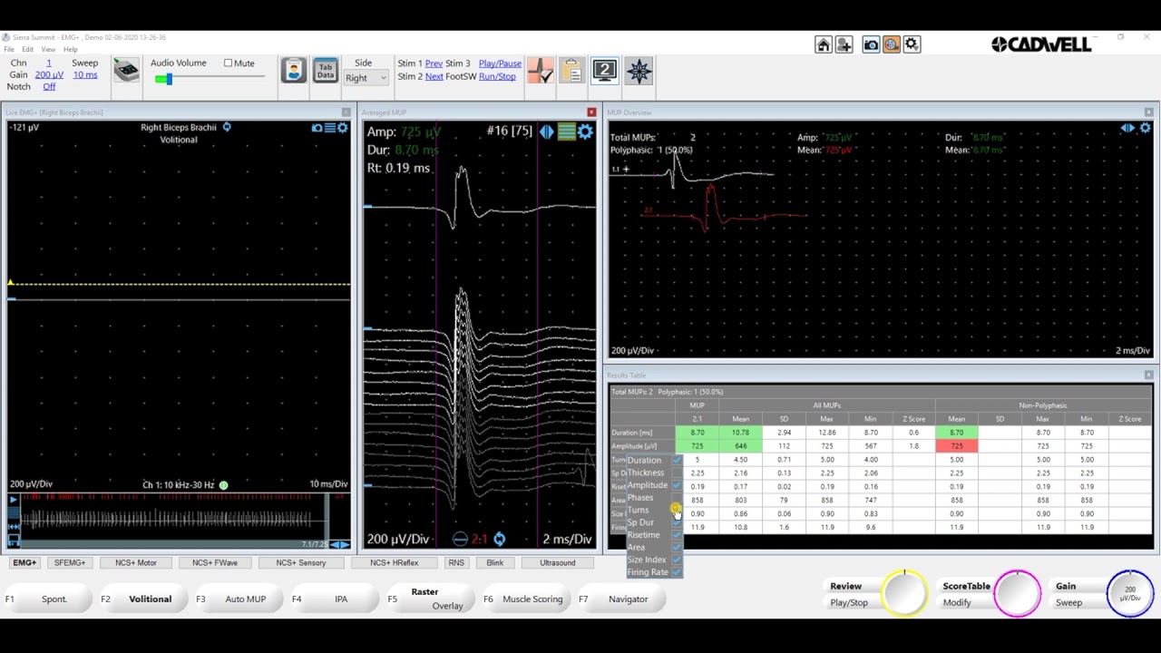 EMG+ Advanced Functions 1   Volitional Cadwell Sierra Summit 3 1
