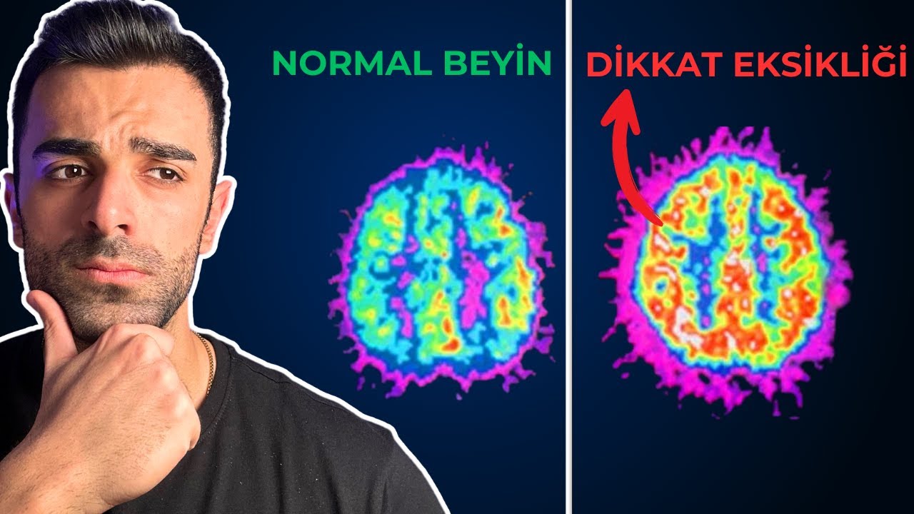 Sorunun Tembellik Değil, Dikkat Eksikliği Olabilir Mi?