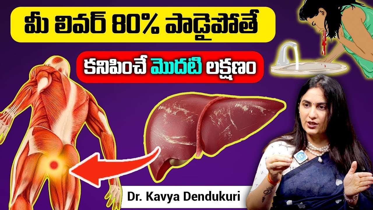 Dr. Kavya - 10 Symptoms of Liver Problem | Fatty Liver Symptoms | liver damage Sign | iDream